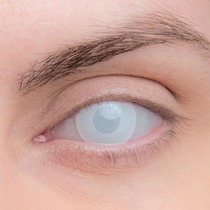 Карнавальные линзы Lensmam Blind White 2